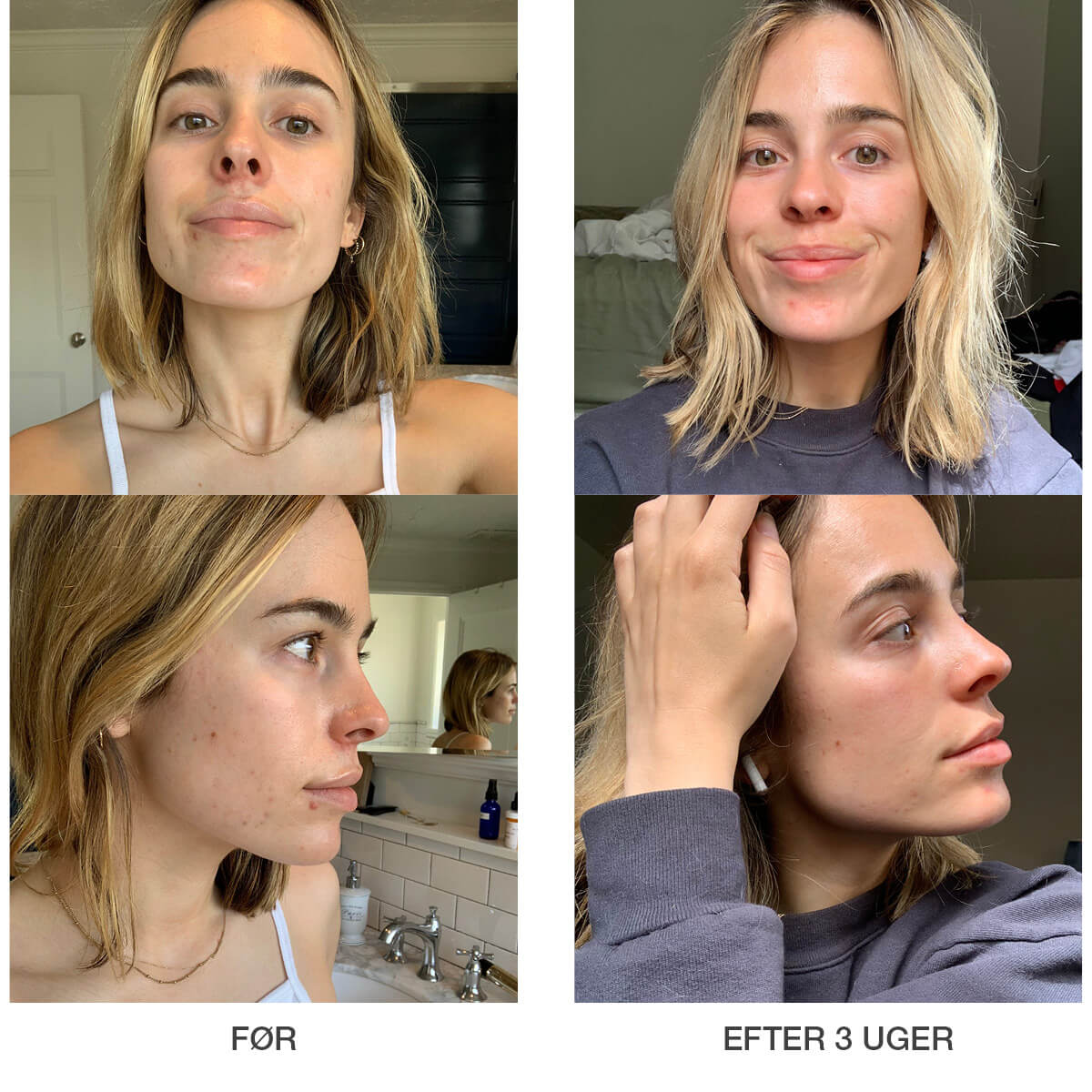 Retinol Clearing Oil