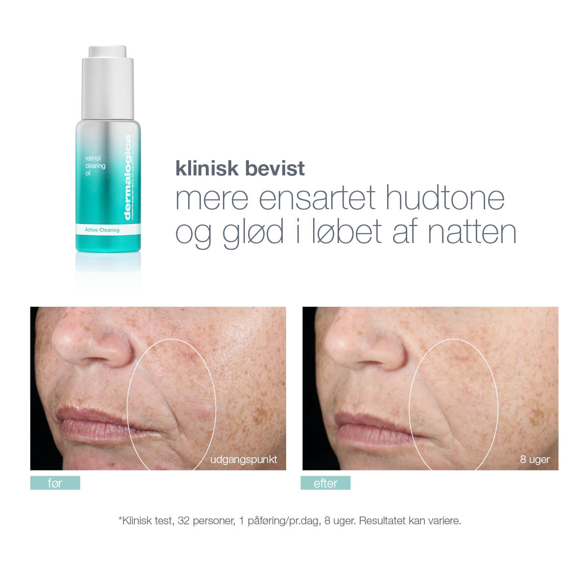 Retinol Clearing Oil