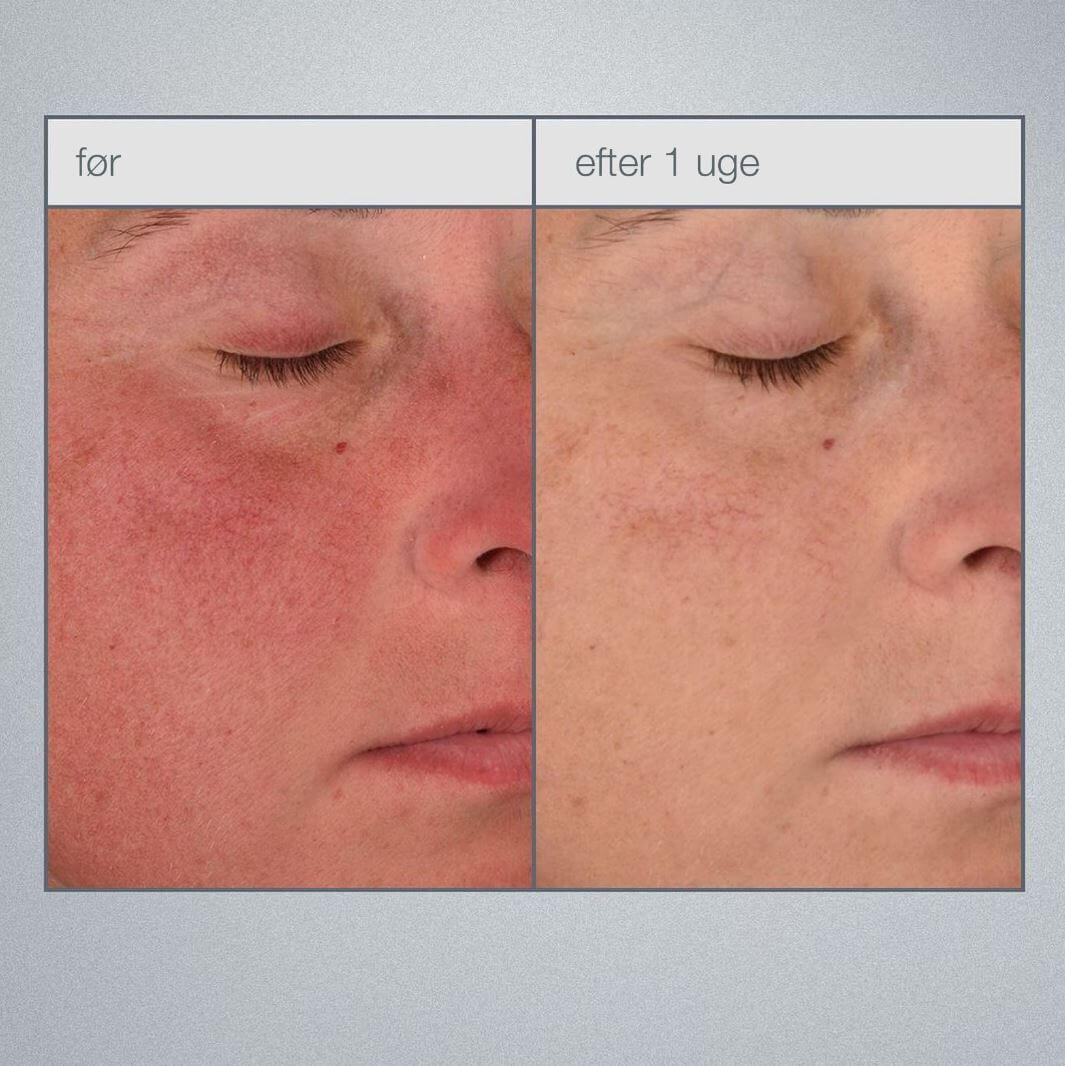 Stabilizing repair cream 50 ml