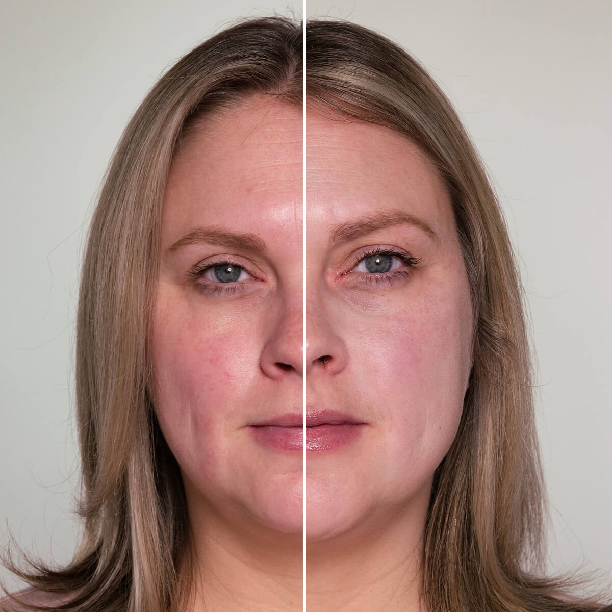 HydroPure Color Correcting Serum med hyaluronsyre & CoQ10