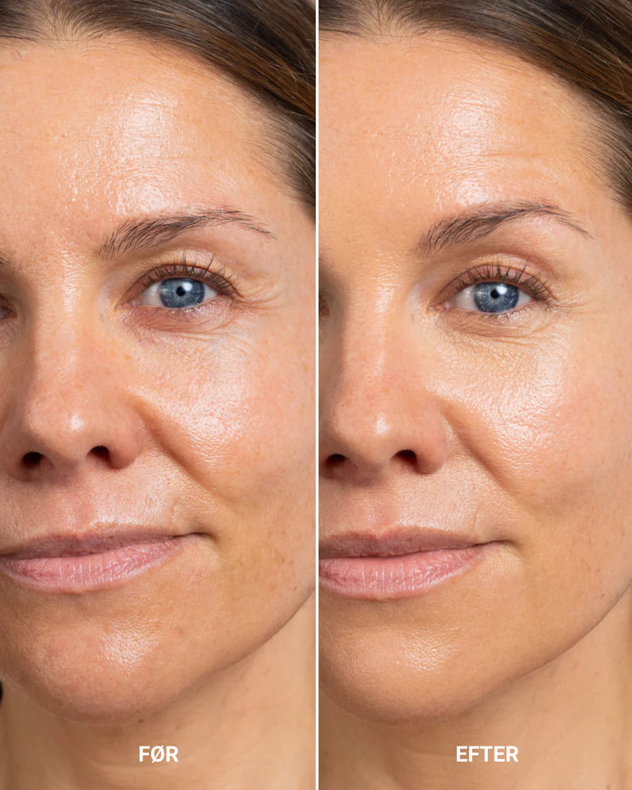 Perfecting concealer - Light/medium neutral golden