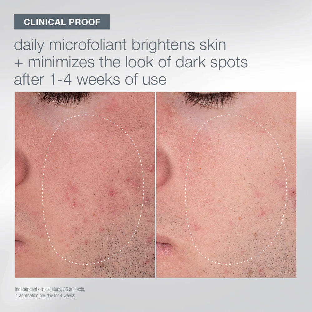 Warmth of the winter sun